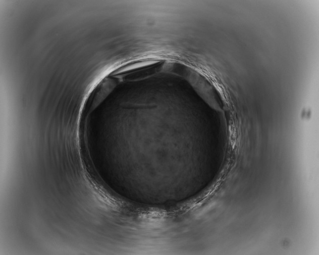 X0000099410196200805161030