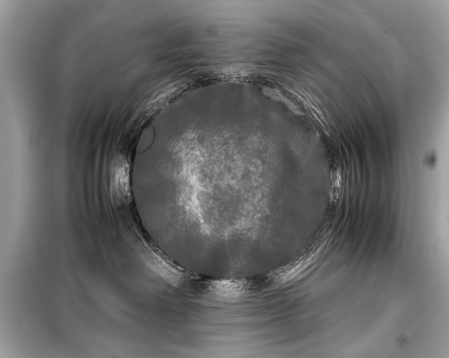 X0000099410238200805161029
