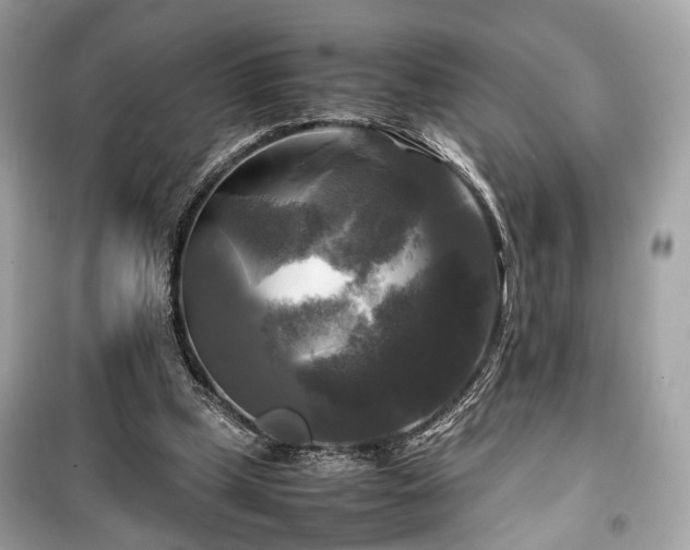 X0000099410249200805161028