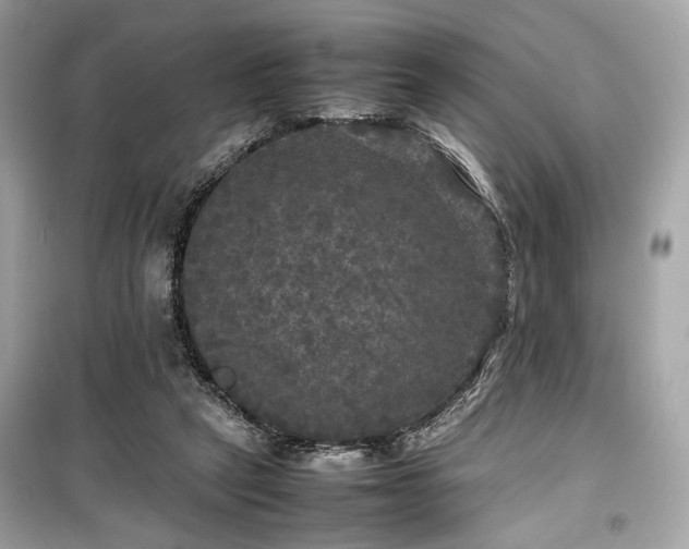 X0000099410257200805161028