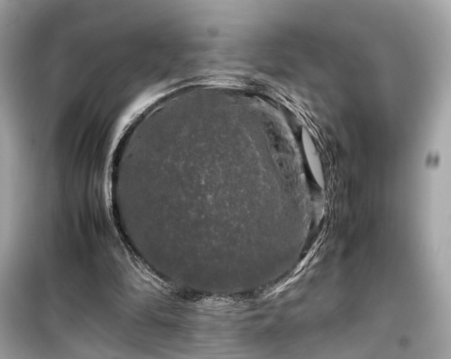X0000099410294200805161028