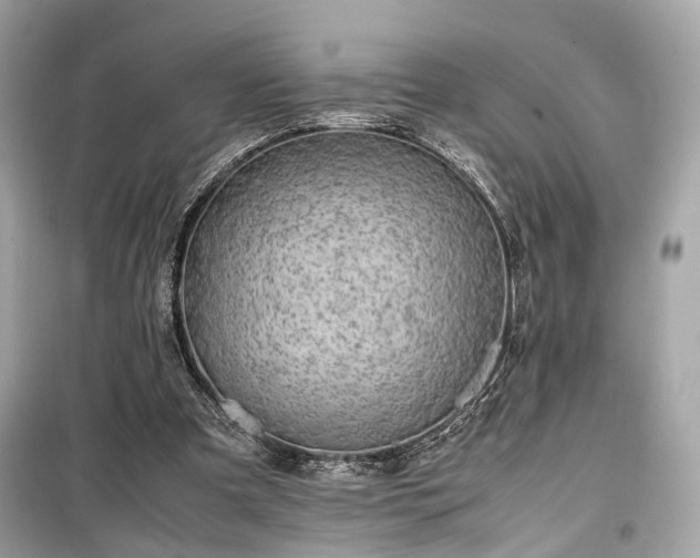 X0000099410297200805161028