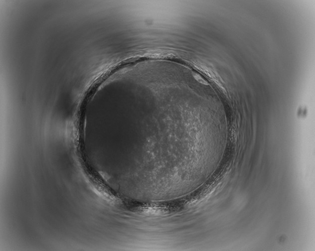 X0000099410303200805161028