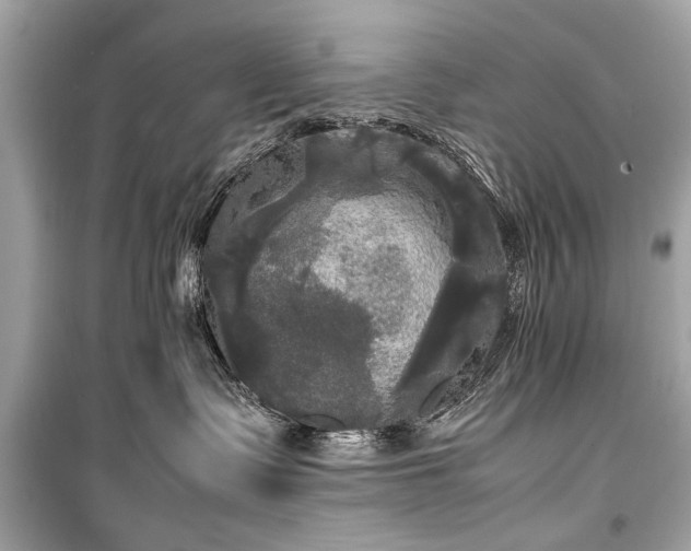 X0000099410335200805161028