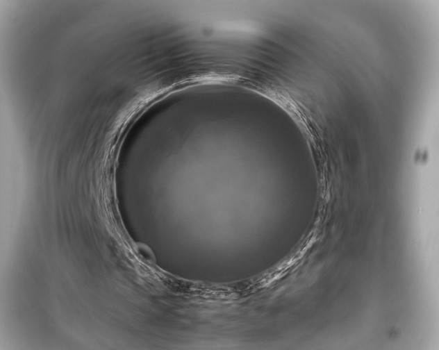 X0000099410337200805161027