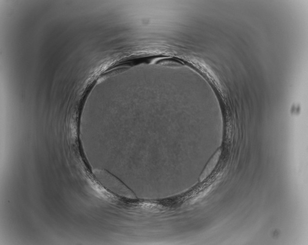 X0000099410393200805161027
