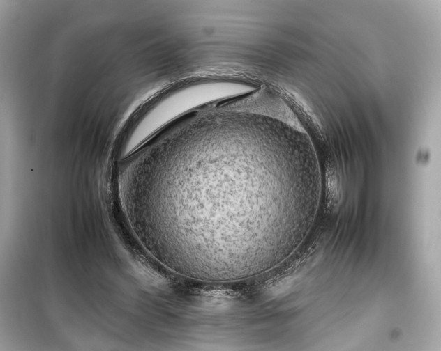 X0000099410396200805161027