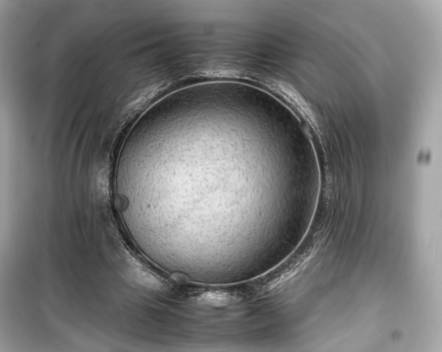 X0000099410441200805161025