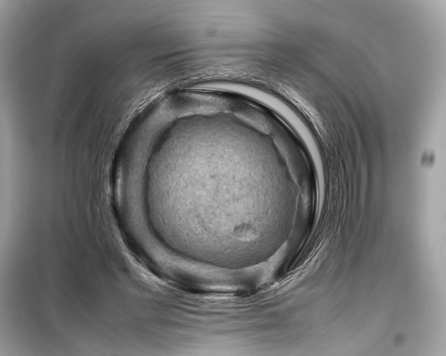 X0000099410493200805161025
