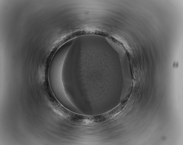 X0000099410496200805161025