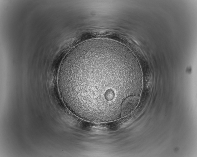 X0000099410515200805161025