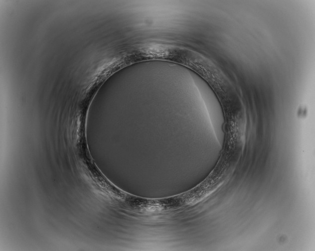 X0000099410600200805161023