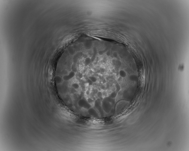 X0000099410619200805161023
