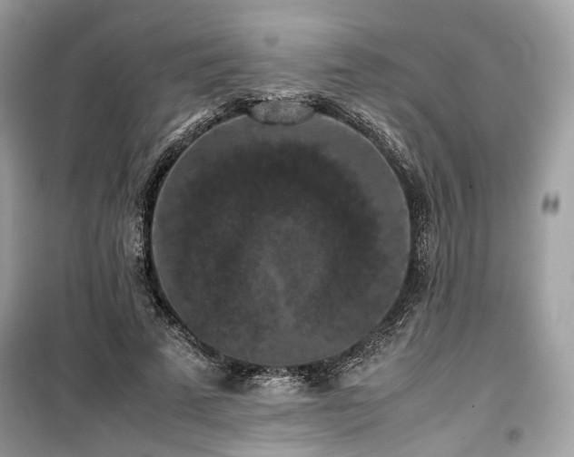 X0000099410689200805161022