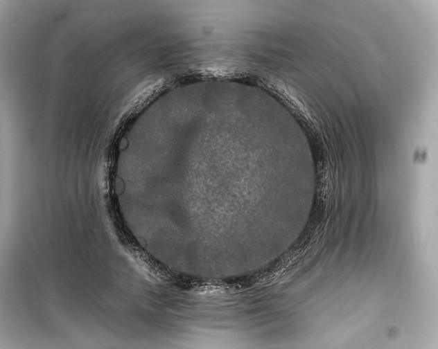 X0000099410738200805161021