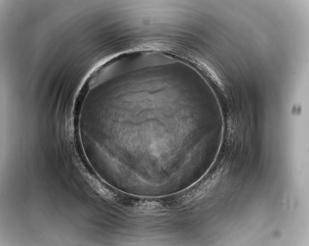 X0000099410784200805161020