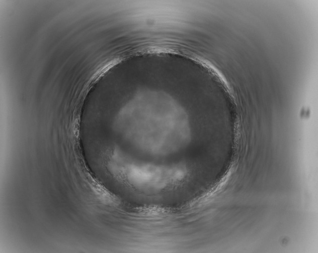 X0000099410785200805161020