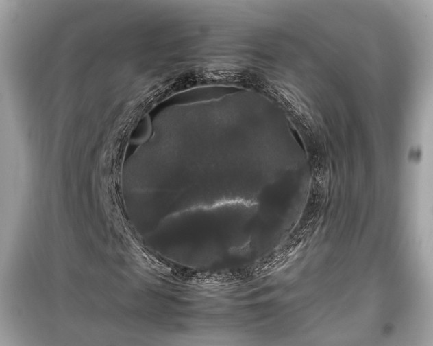 X0000099410817200805161019