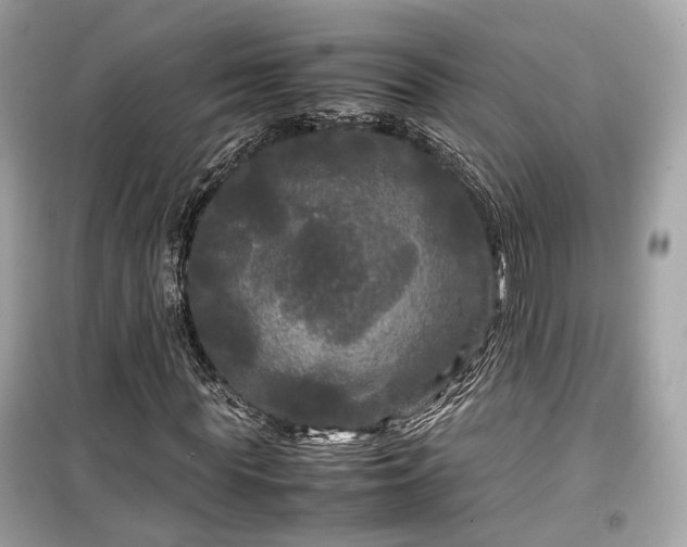 X0000099410819200805161019
