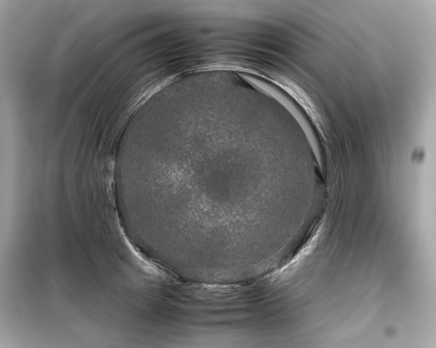 X0000099410849200805161019