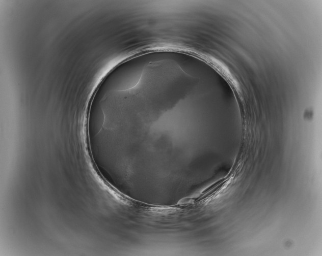 X0000099410863200805161020