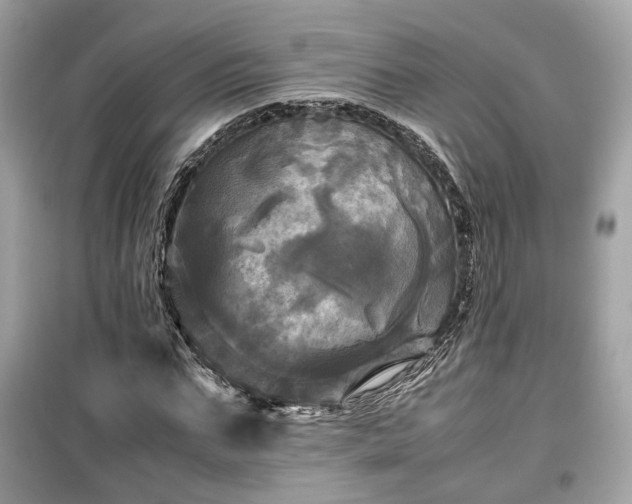 X0000099410871200805161019