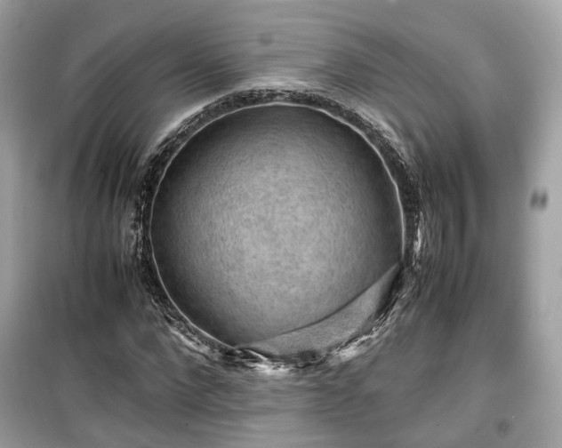 X0000099410872200805161019