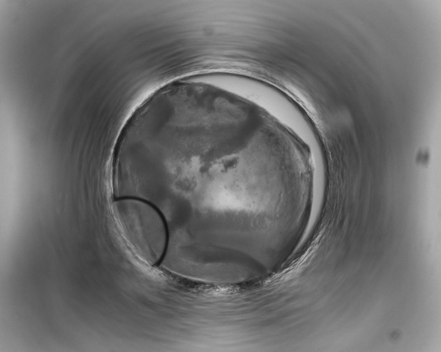 X0000099410891200805161019