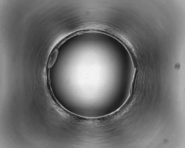 X0000099410936200805161018
