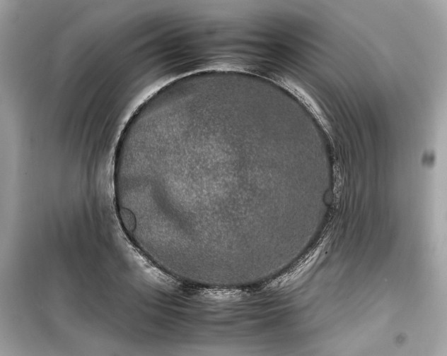 X0000099410939200805161018