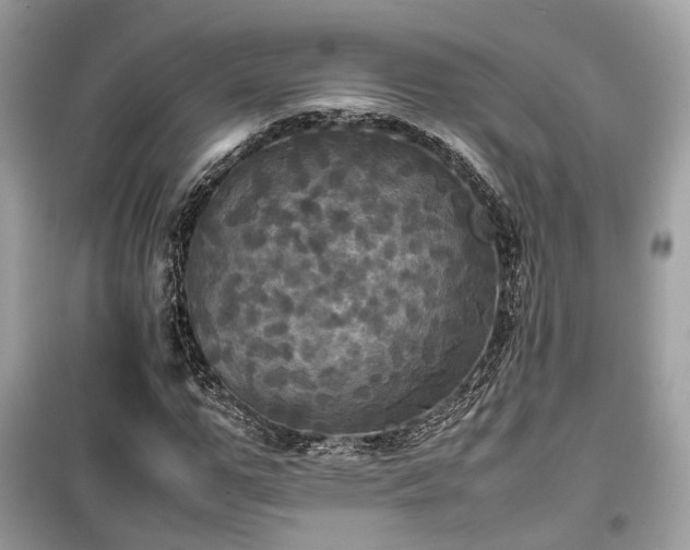 X0000099410967200805161017