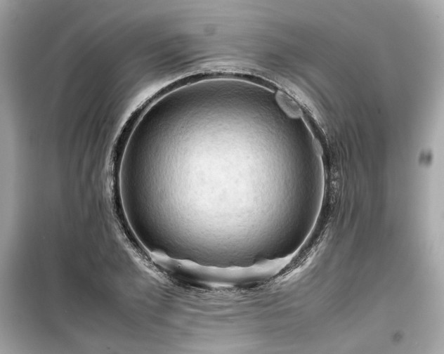 X0000099410981200805161017