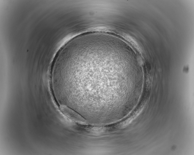 X0000099410989200805161017
