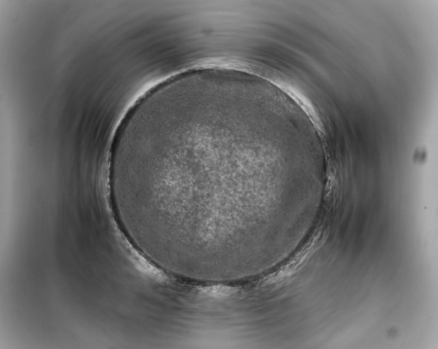 X0000099410992200805161017