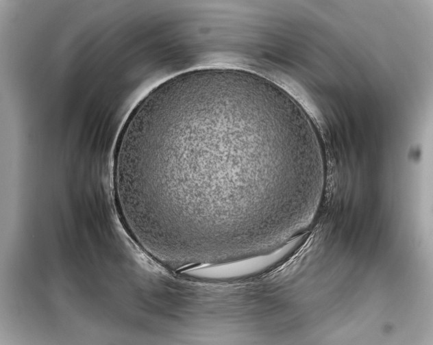 X0000099410996200805161017
