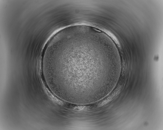 X0000099411000200805161017