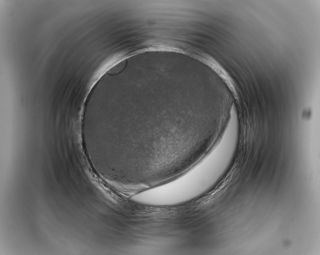 X0000099411002200805161017