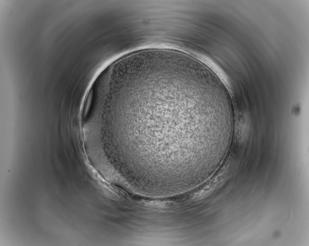 X0000099411004200805161017