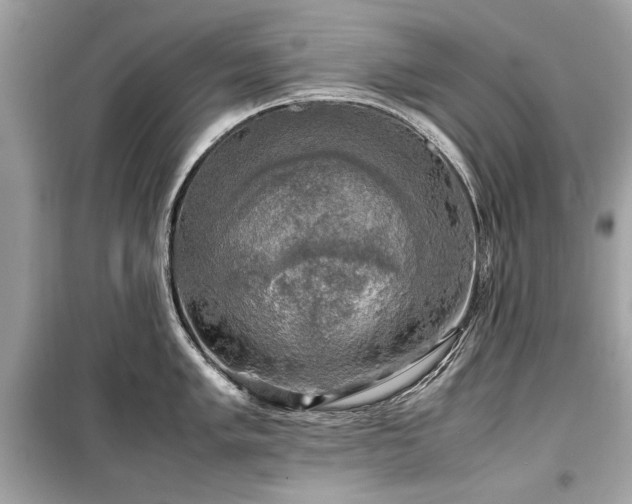 X0000099411005200805161017