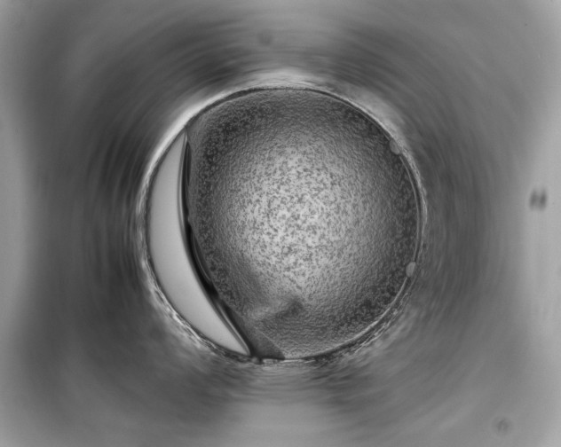 X0000099411008200805161017