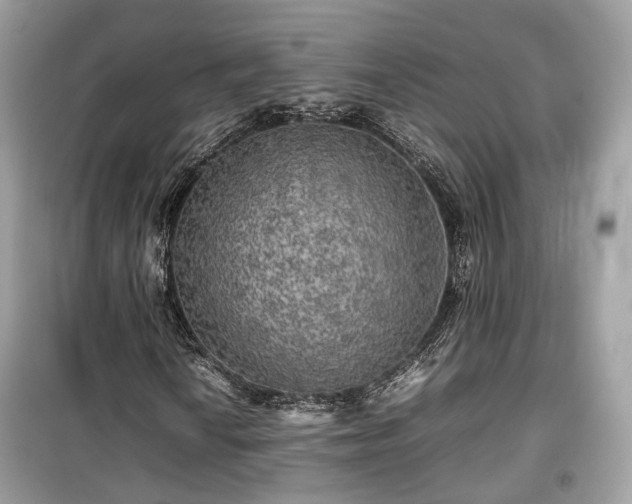 X0000099411010200805161016