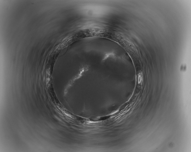 X0000099411011200805161016