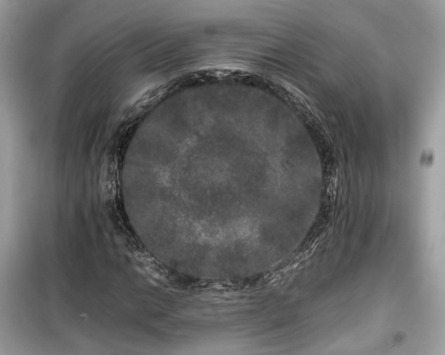 X0000099411014200805161016