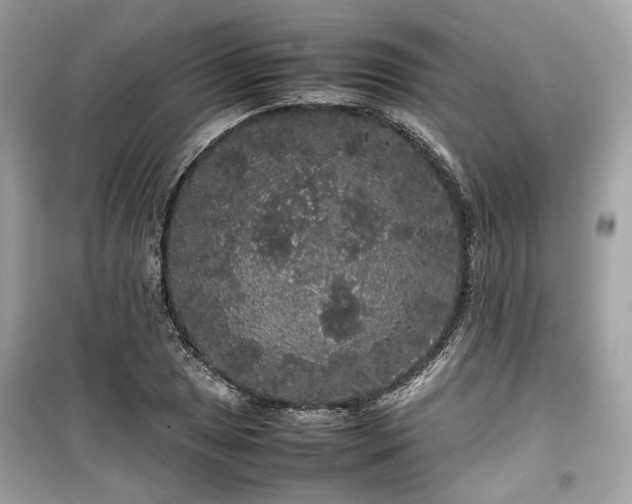 X0000099411025200805161016