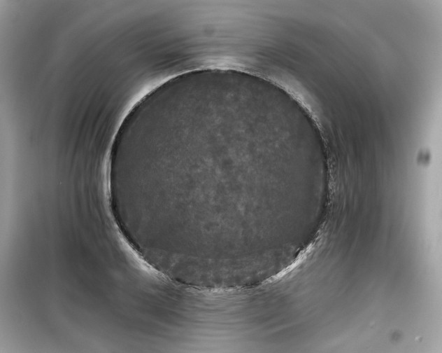X0000099411032200805161016