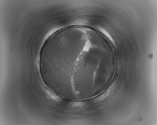 X0000099411035200805161016