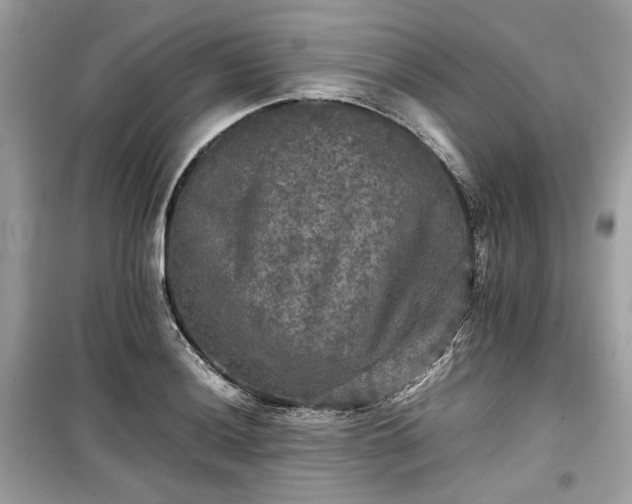 X0000099411036200805161016