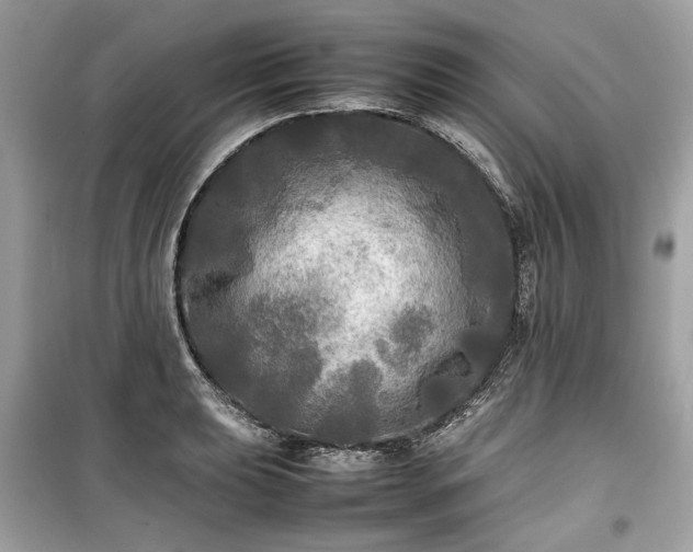X0000099411039200805161016