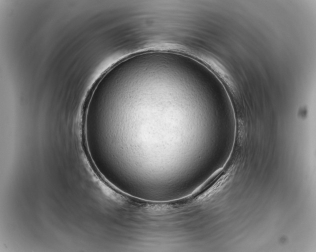 X0000099411046200805161016
