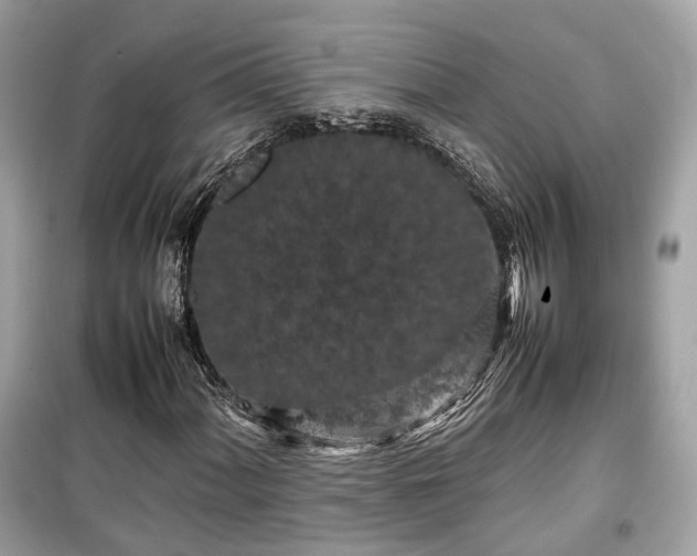 X0000099411060200805161015
